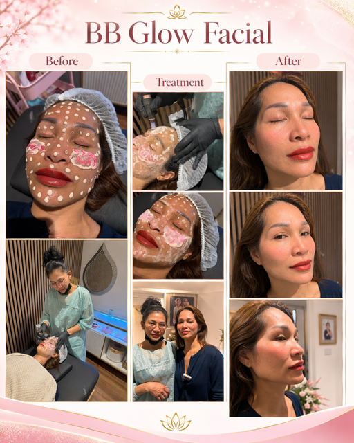 BB Glow facial treatment process